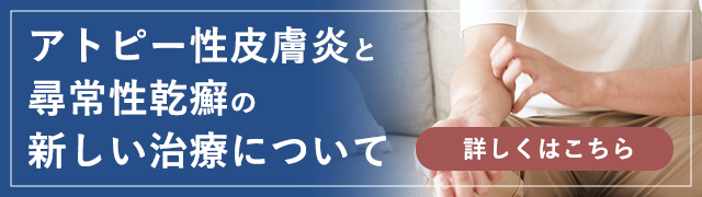 アトピー性皮膚炎と尋常性乾癬の新しい治療について